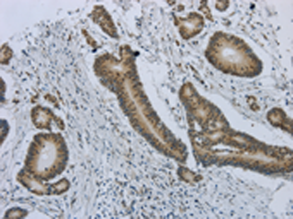 MMP24