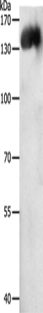 PECAM1