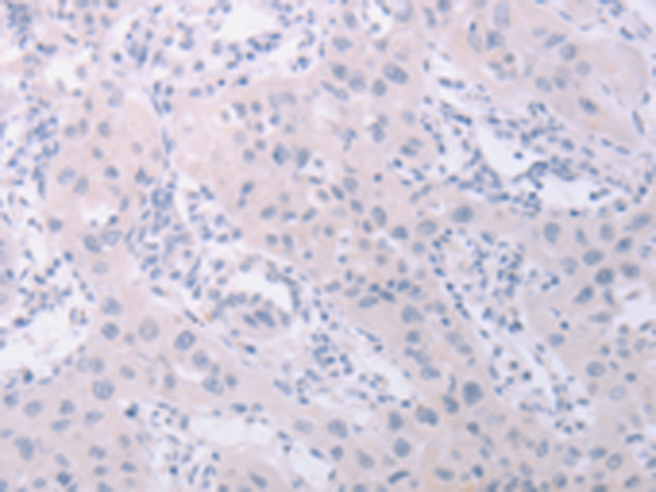 PKD2L1