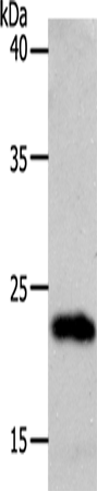 SOCS1