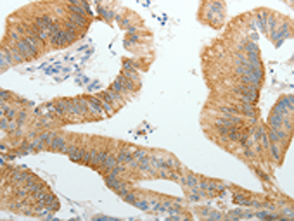 PGBD5 