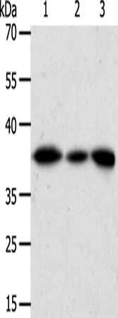 AKR1A1