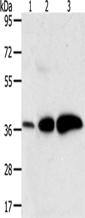AKR1C1