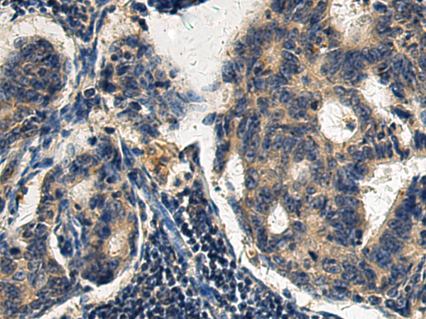BOK(BH3 domain)