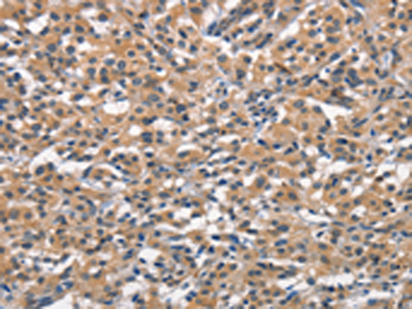 OLR1