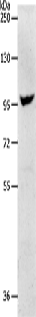 NFATC2