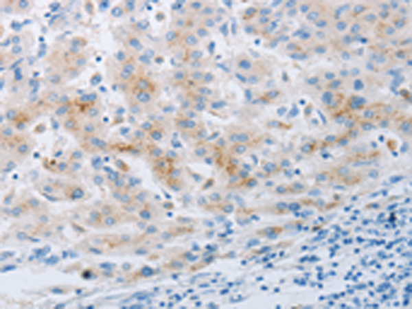 Rabbit Polyclonal Antibody to NPY2R