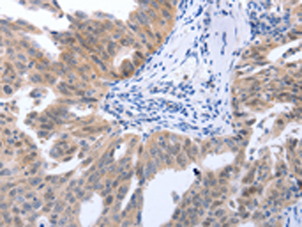 Rabbit Polyclonal Antibody to MAP2K1