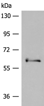 PAK3