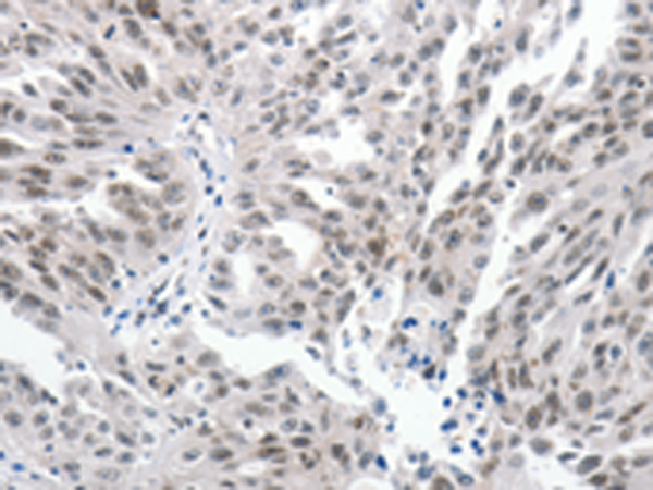 PKD2
