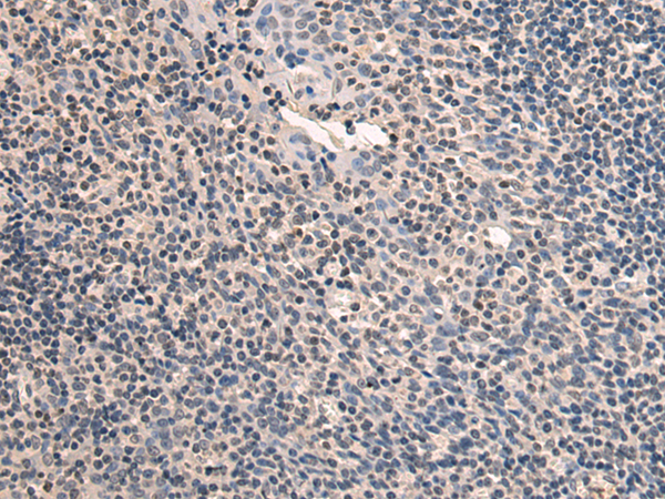 SLC24A1