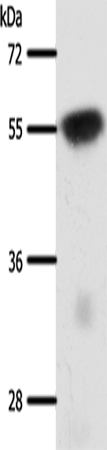 SLC32A1