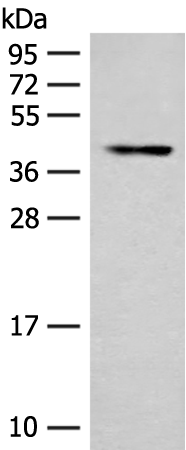 SSTR2