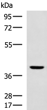 SSTR5