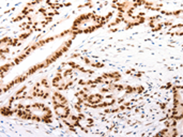CASP9 (active)