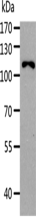 AARS1