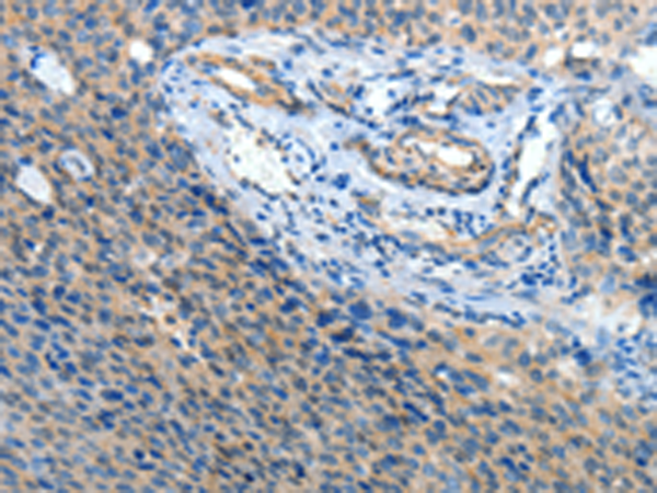 ATP1A1