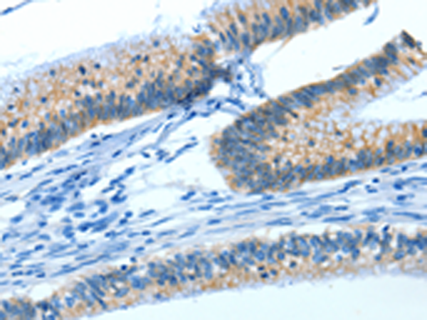 Rabbit Polyclonal Antibody to ATP1A1