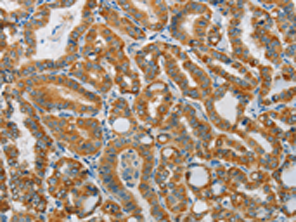 Rabbit Polyclonal Antibody to PITX3