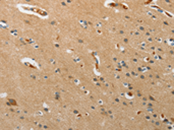 Rabbit Polyclonal Antibody to PITX3