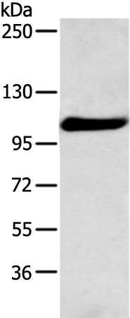 FOLH1