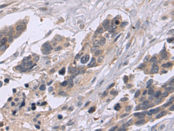 CD24
