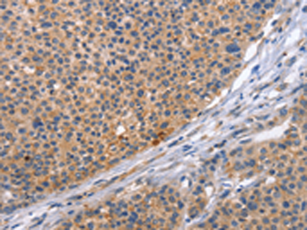CD5L