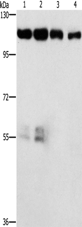 CDK11A/CDK11B