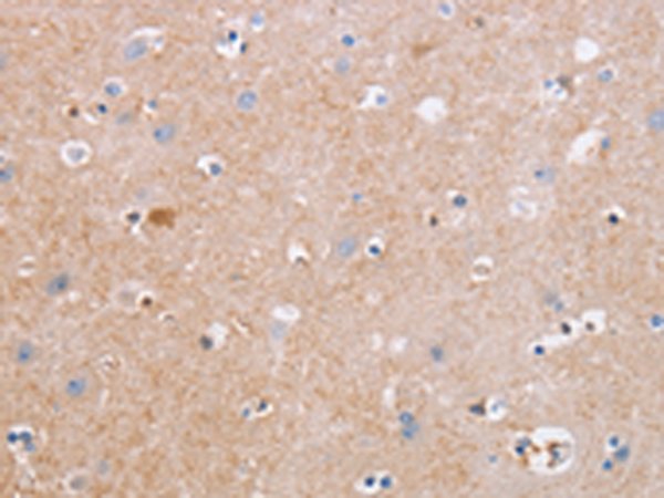 CDC7