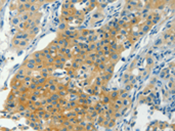 CHRNA2