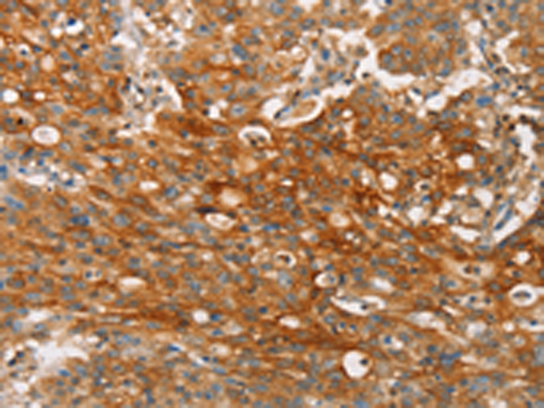 CLDN11