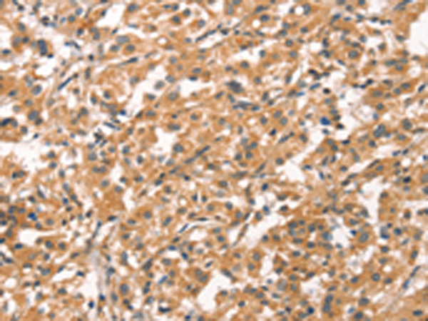 CYP46A1