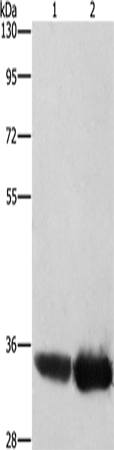 AIMP1