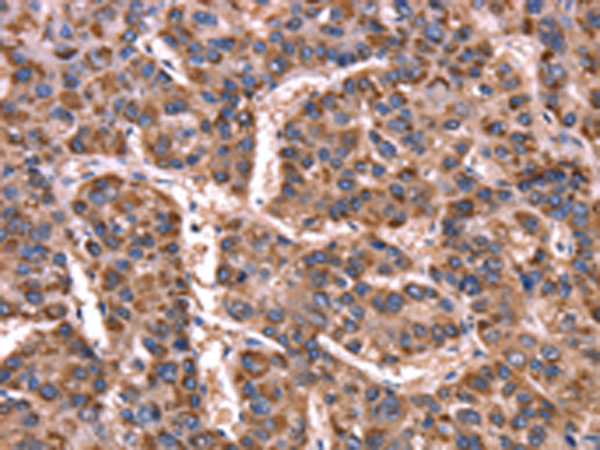GCG(GLP2)