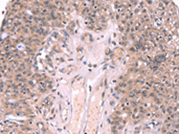 EXTL1