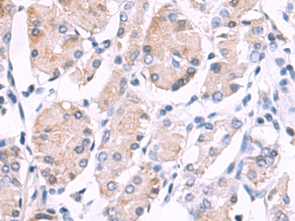 Rabbit Polyclonal Antibody to FUT8