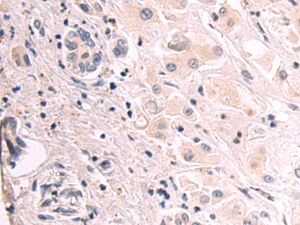 Rabbit Polyclonal Antibody to FUT8