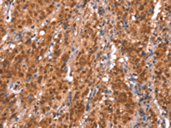 KCNJ6
