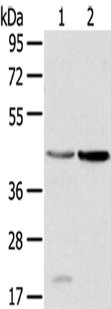 HSD11B2