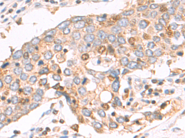 Rabbit Polyclonal Antibody to ITGA11