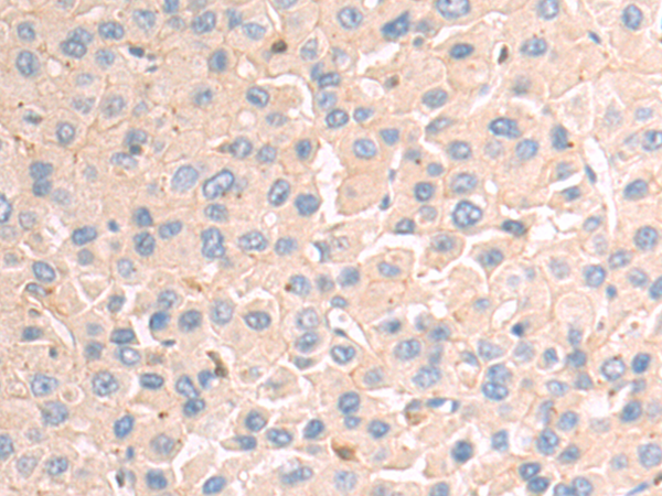 Rabbit Polyclonal Antibody to ITGA11