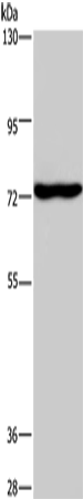 KCND1