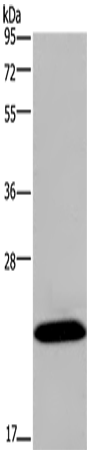 KCNMB4