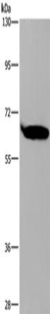 SLC22A2