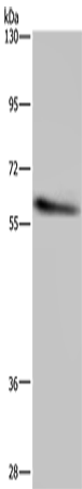 CYP1A2