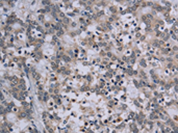 TP53AIP1