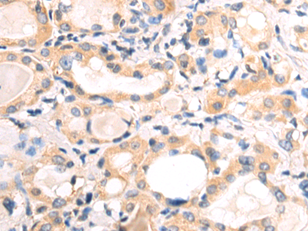 Rabbit Polyclonal Antibody to PDE5A