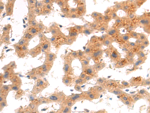 Rabbit Polyclonal Antibody to PDE5A
