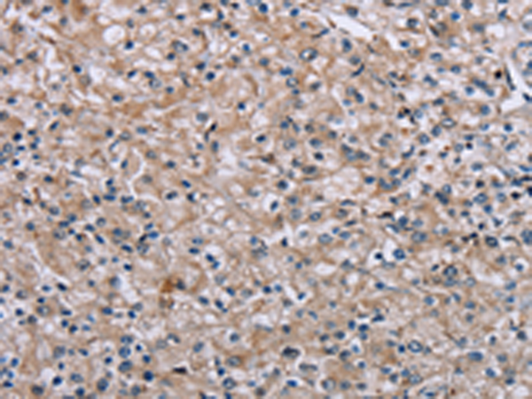 PLCL1