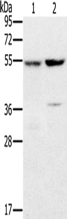 PPM1F